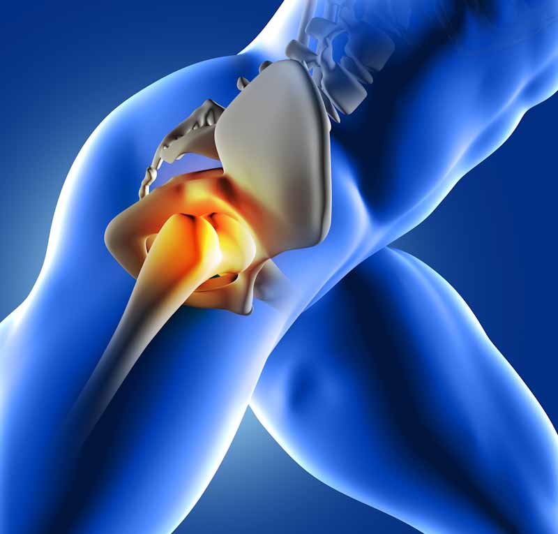 Hip fracture treatment in Hyderabad